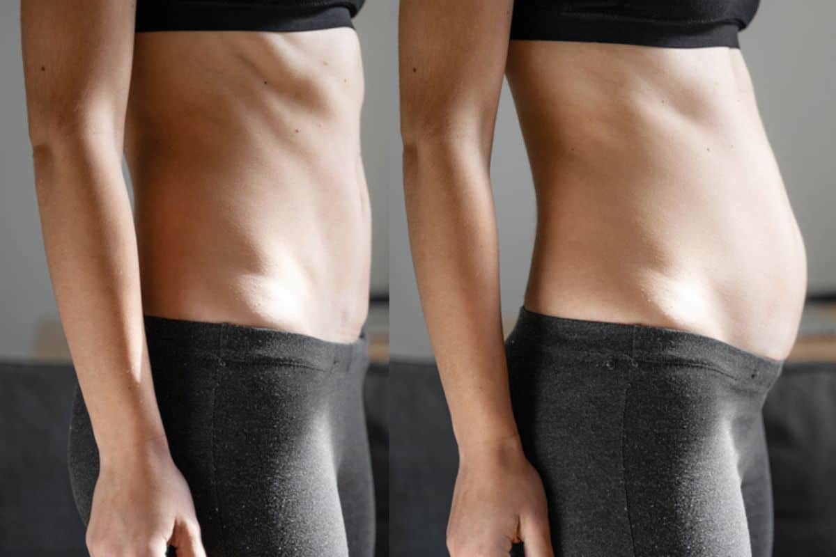 How long does diastasis recti take to improve Marlborough?