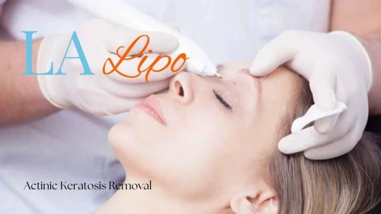 Woman receiving Actinic Keratosis Removal Treatment Marlborough