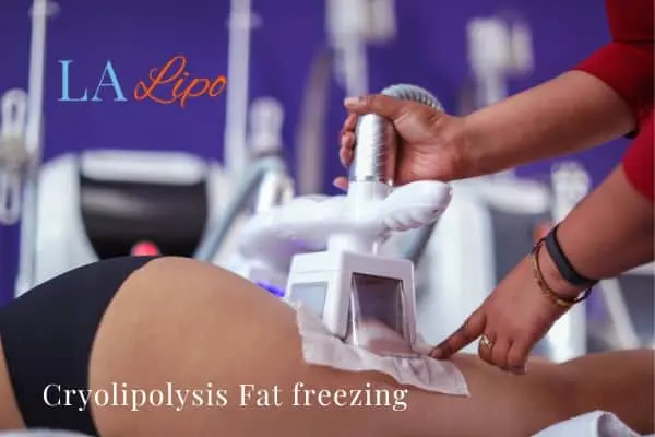 women getting fat freezing Marlborough