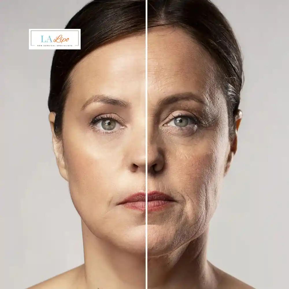 How Can You Tell If Non-Surgical Skin Tightening Is Right for You Marlborough?