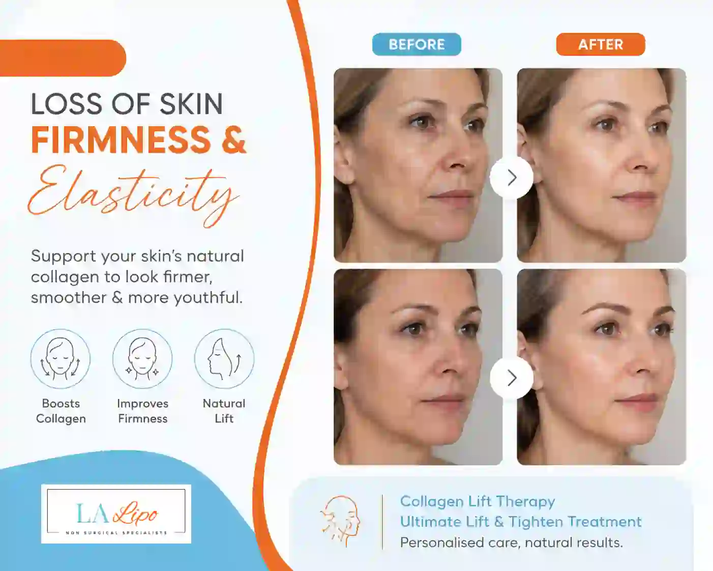 Sign #7: Loss of Skin Firmness and Elasticity Marlborough